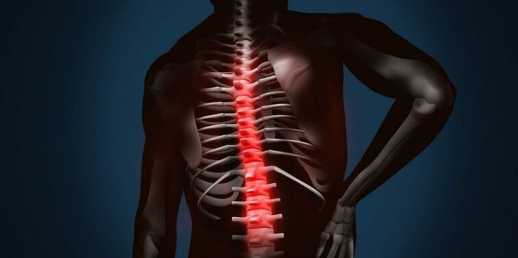 léze páteře v důsledku osteochondrózy